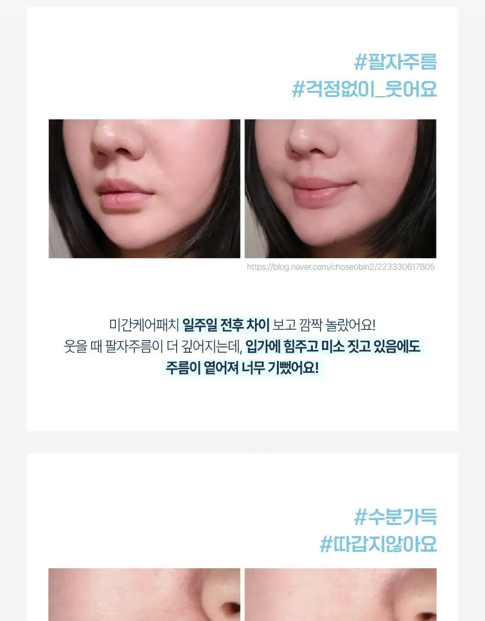 [OY단독] 라보타치 미간 케어 패치 18매 상세페이지 4